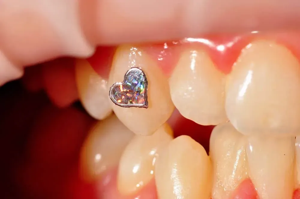 About Tooth Jewelry