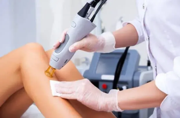 Laser Hair Removal in Iran