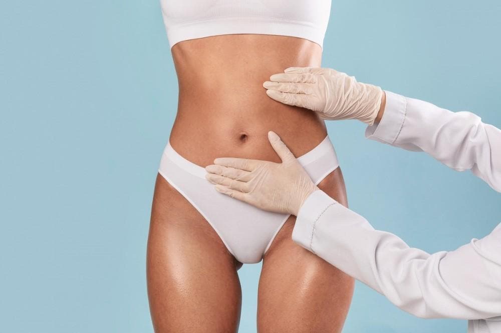 Coolsculpting vs. Liposuction