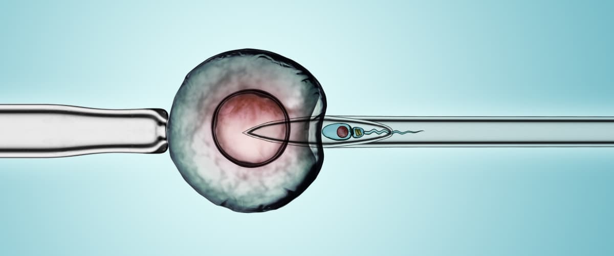ICSI Success Rates in Iran