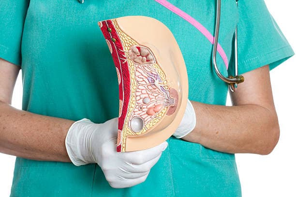 What Causes Chest Fat?