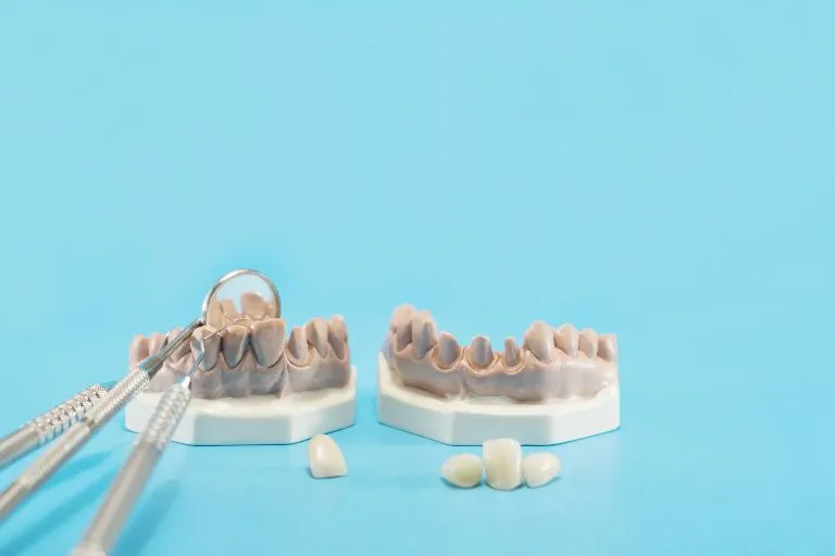 When would you need a dental crown?